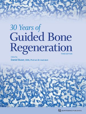 cover image of 30 Years of Guided Bone Regeneration